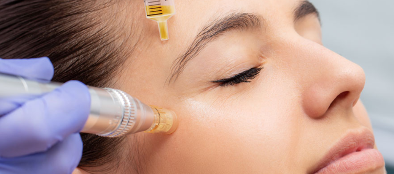 Platelet-Rich Plasma (PRP) Therapy